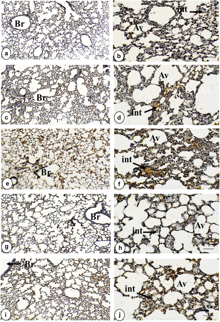 Morphometric analysis and immunobiological investigation of <i>Indigofera oblongifolia</i> on the infected lung with <i>Plasmodium chabaudi</i>.