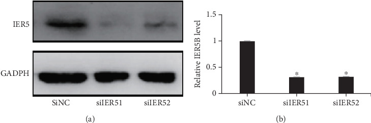 IER5 Negatively Regulates Cdc25B Expression in HeLa Cells After Gamma Ray Irradiation.