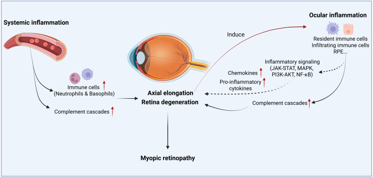 The role of inflammation in myopic retinopathy.