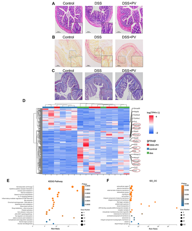 Pitavastatin reduces intestinal fibrosis in chronic colitis and inhibits colon fibroblast activation by enhancing MMP-9 expression via the IGF-1/IGF-1R pathway.