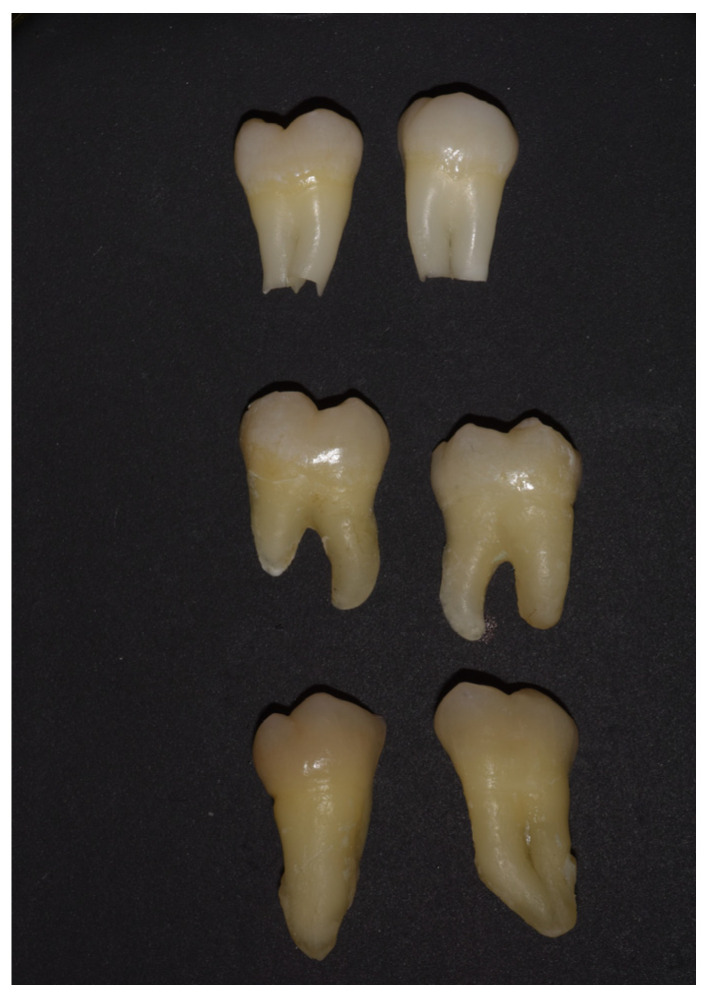 In Vitro Evaluation of Chemical and Microhardness Alterations in Human Enamel Induced by Three Commercial In-Office Bleaching Agents.
