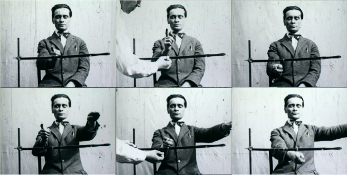 One hundred years of neuropsychology: Kurt Goldstein's seminal paper on the inherent complexity of symptoms.