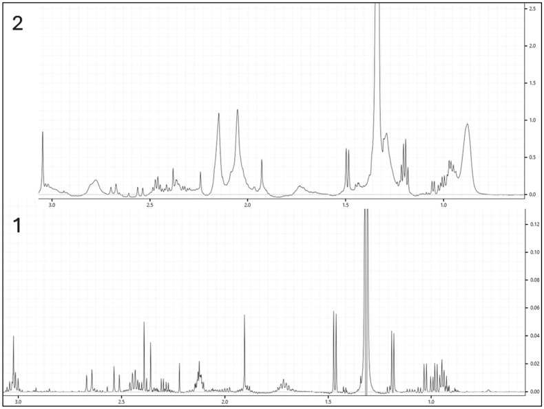 <sup>1</sup>H Nuclear Magnetic Resonance (NMR) Metabolomics in Rodent Plasma: A Reproducible Framework for Preclinical Biomarker Discovery.