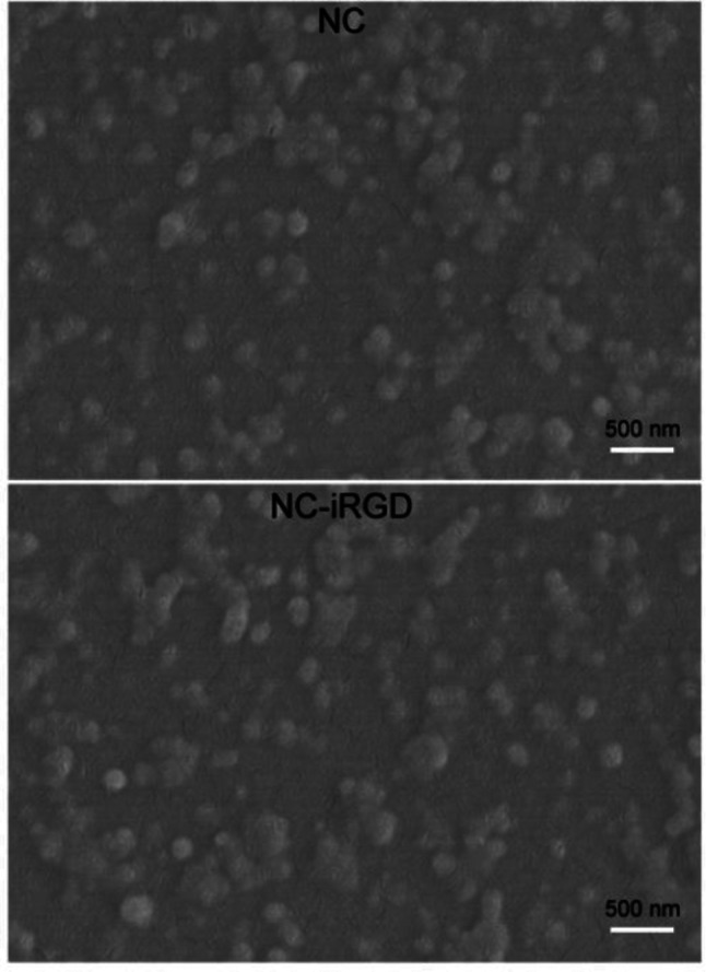 Preparation and characterization of a iRGD-modified recombinant spider silk particles for antitumor polypeptide drug delivery into cancer cells.