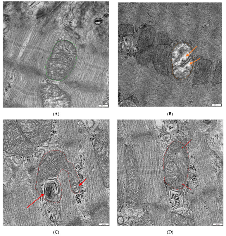 Protocol for the Systematic Quantitative Ultrastructural Analysis of Mitochondria in Cardiac Tissue.