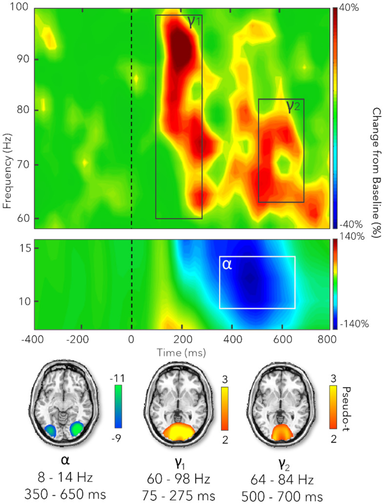 Developmental shifts in testosterone levels are associated with alterations in the neural oscillatory dynamics serving selective attention.