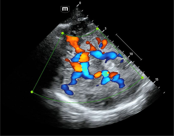 Transcranial ultrasound in the critically ill patient: a narrative review.