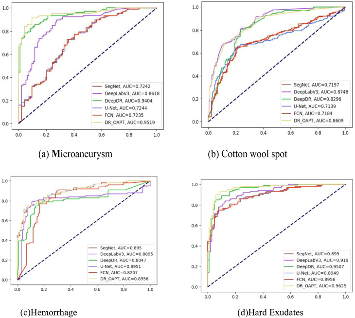 Development and validation of a deep learning model for early detection and screening of diabetic retinopathy.