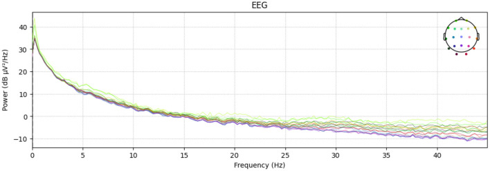 Privacy-preserving dementia classification from EEG via hybrid-fusion EEGNetv4 and federated learning.