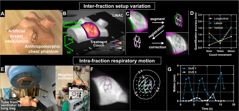 Cherenkov Imaged Bio-Morphological Features Verify Patient Positioning With Deformable Tissue Translocation in Breast Radiation Therapy.