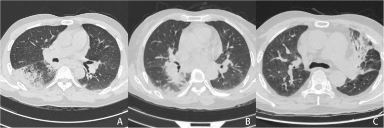 Central nervous system infections in patients with anti-interferon-γ autoantibodies: case series and review of the literature.