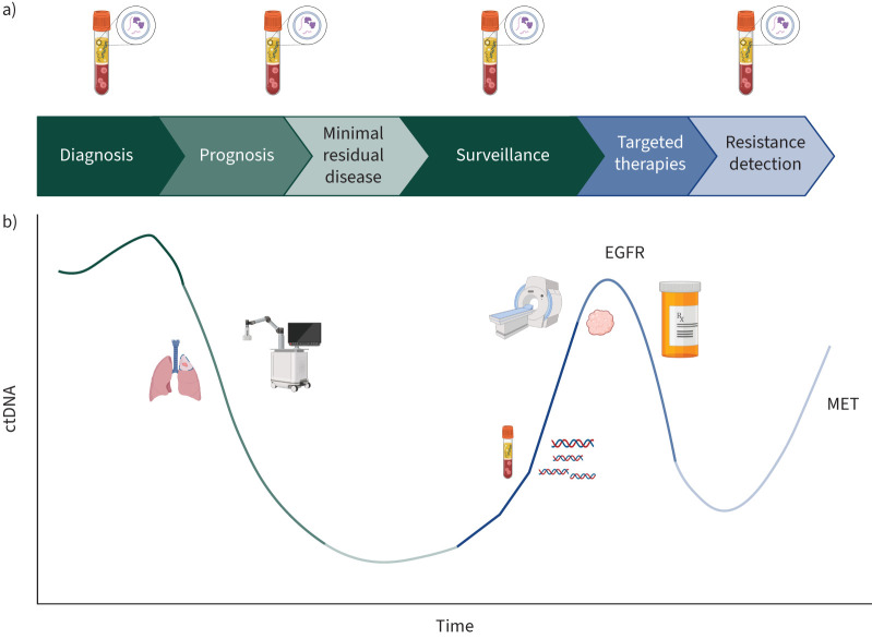 Liquid biopsy in lung cancer.