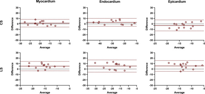 A comparative analysis of myocardial strain and strain rate in cardiac computed tomography and magnetic resonance feature tracking.