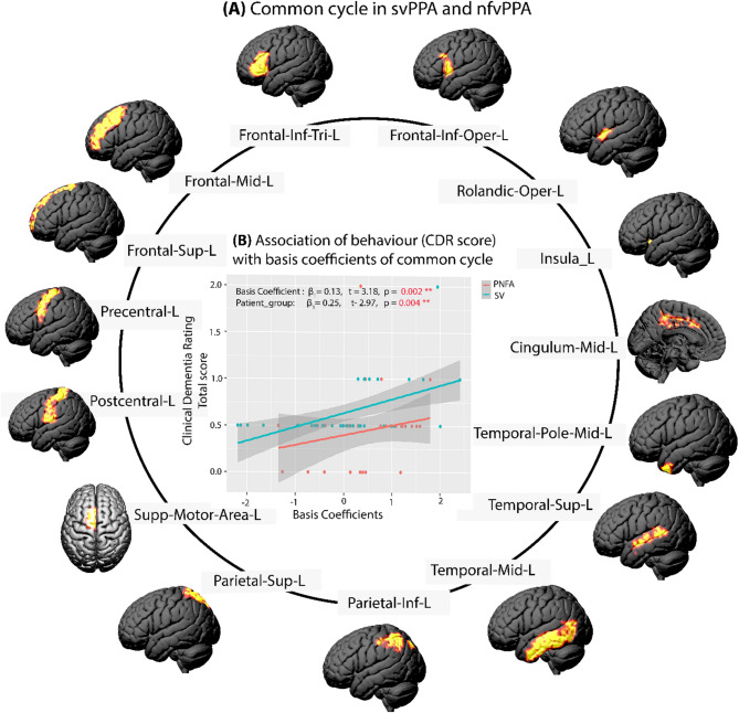 Longitudinal evaluation of common and unique brain-networks in variants of primary progressive aphasia.