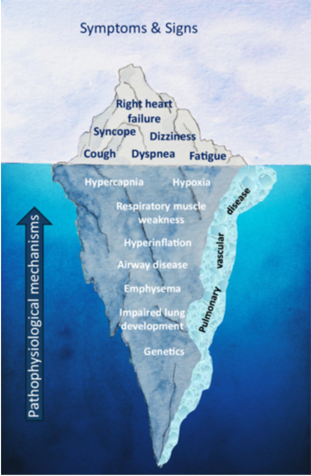 Significance of Pulmonary Vascular Dysfunction in Chronic Obstructive Pulmonary Disease.