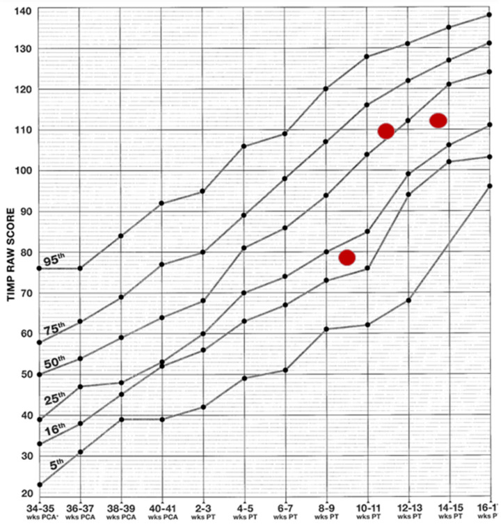 Case Report of a Neonate with Severe Perinatal Asphyxia: A Multidisciplinary Approach Involving Therapeutic Hypothermia and Physiotherapy.