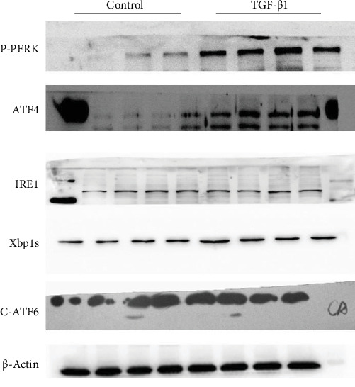 Corrigendum to "Inhibition of Mitofusin-2 Promotes Cardiac Fibroblast Activation via the PERK/ATF4 Pathway and Reactive Oxygen Species".