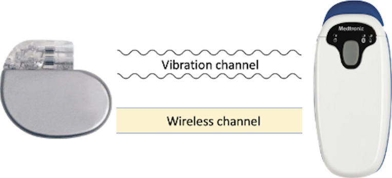 Using Vibration for Secure Pairing With Implantable Medical Devices: Development and Usability Study.