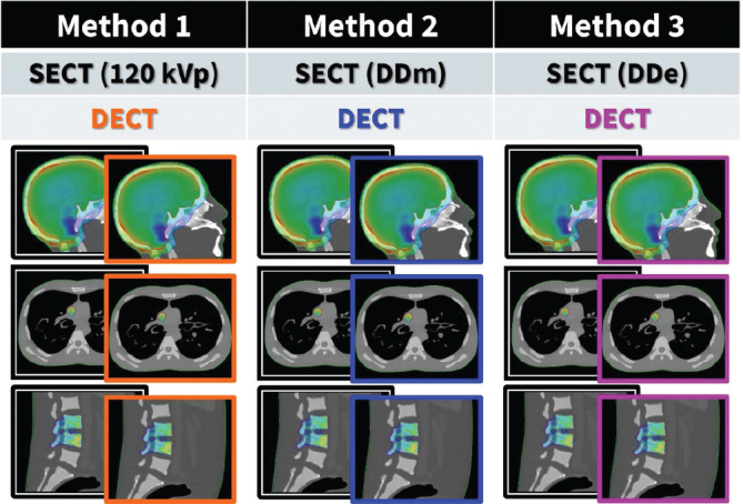 Combined single- and dual-energy CT workflow for dose calculation in radiotherapy.