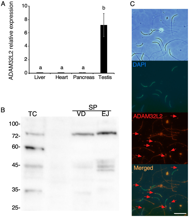 Expression, Localization, and Processing of Chicken Sperm ADAM32L2 during the Acrosome Reaction: A Possible Function in the Sperm-Egg Interaction.