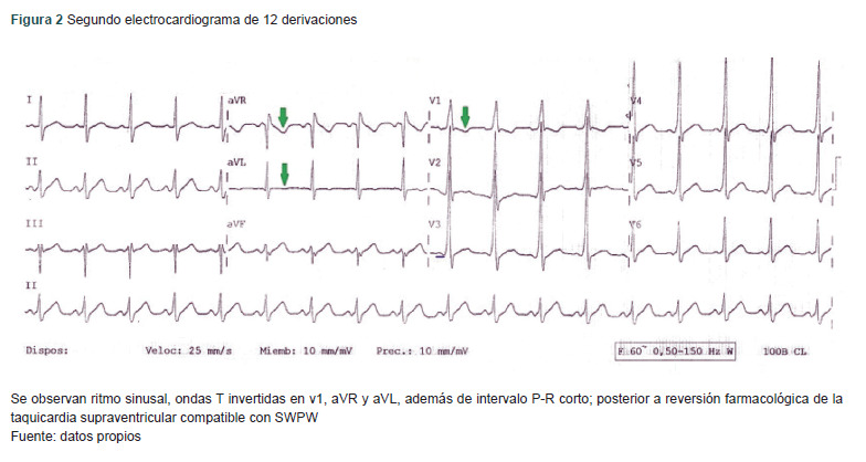 [Wolff-Parkinson-White syndrome due to cocaine use: a case report].