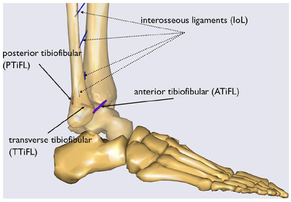 A Pilot Validation Study of a Biomechanical Simulation Model for Rotational Ankle Injuries Using Robotic Cadaveric Testing.
