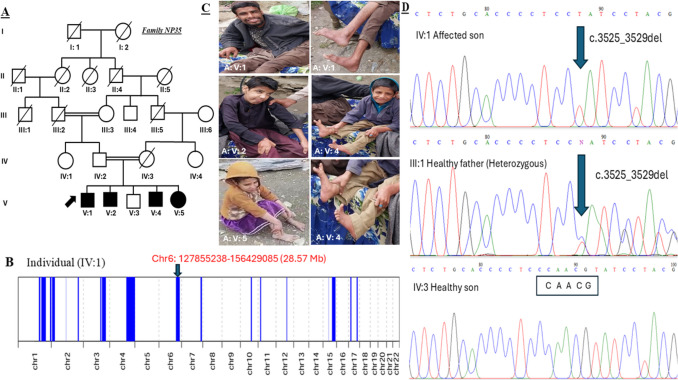 Identification of a Novel GRM1 Frameshift Variant in Two Pakistani Families Broadens the Genetic Landscape of Ultra-Rare Spinocerebellar Ataxia Type 13.