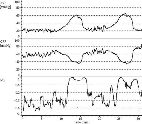 Transcranial ultrasound in the critically ill patient: a narrative review.