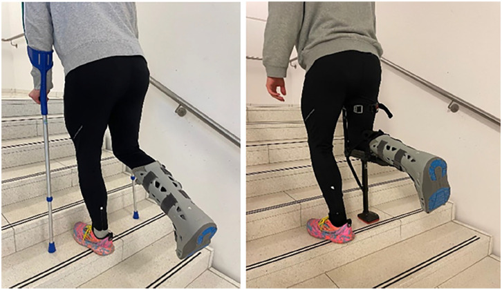 Patient Preferences and Functional Outcomes of Forearm Crutches vs Hands-Free Single Crutches After Foot and Ankle Surgery: A Randomized Crossover Trial.