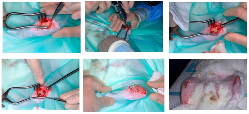Controlling Sodium Titanate Crystal Size to Improve Wettability and Early Osseointegration of Titanium Implants: Insights from an Animal Model.