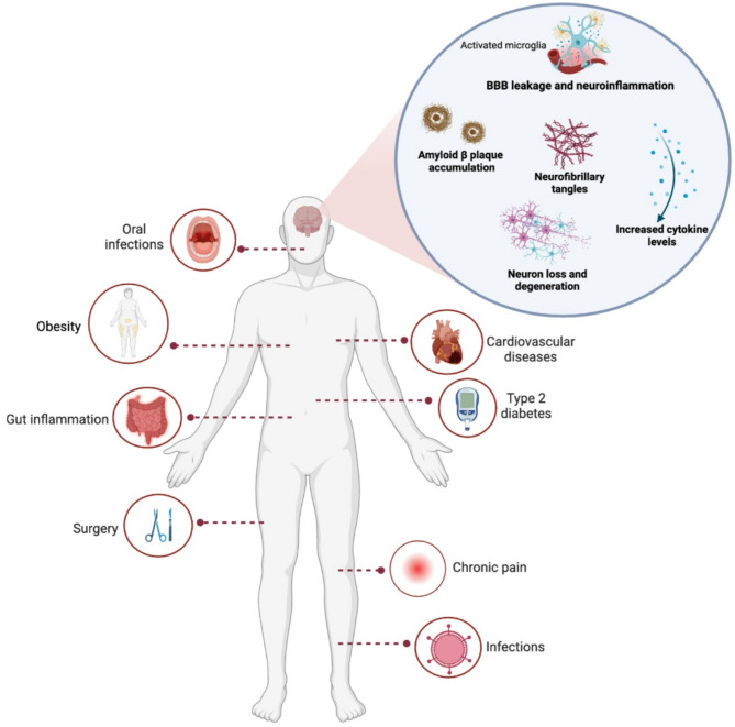 Systemic inflammation as a central player in the initiation and development of Alzheimer's disease.