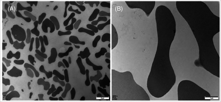 The impact of pressure and temperature on the quality of suspended red blood cells: An ex vivo simulation study.