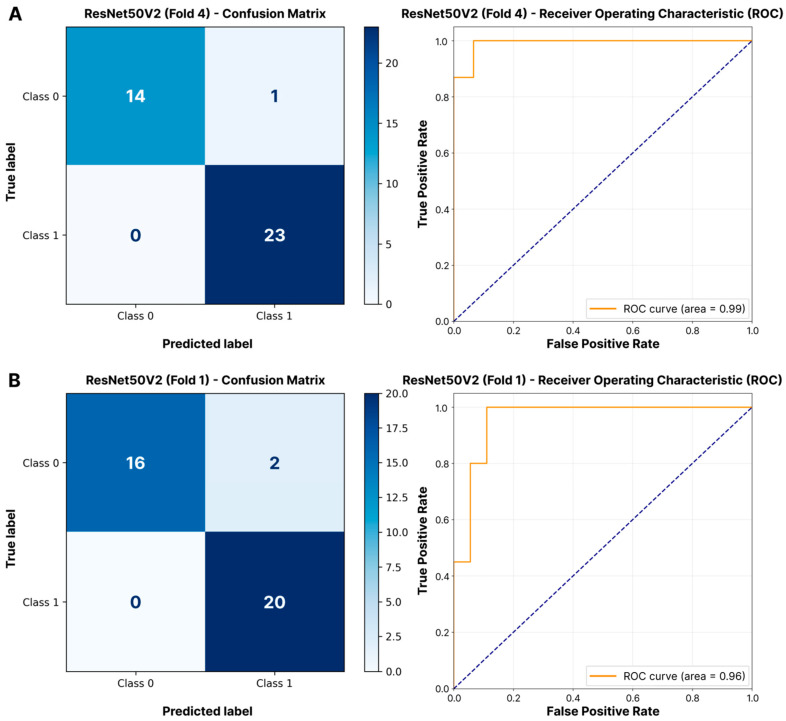 Evaluation of Transfer Learning Efficacy for Surgical Suture Quality Classification on Limited Datasets.