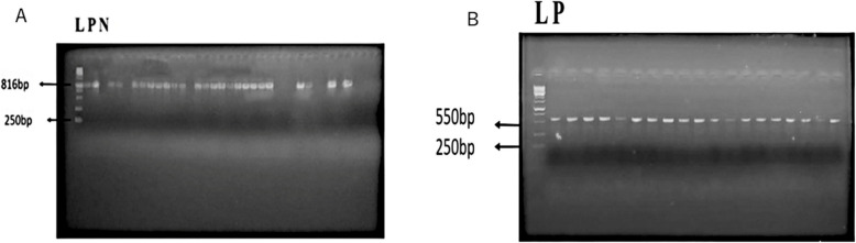 Epidemiology, antibiotic resistance, and molecular detection of blaOXA and blaCTX-M Genes in ESBL-Producing Escherichia coli from urinary tract infections in Jordanian hospitals.