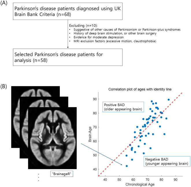 Buffering brain aging: education moderates language impairment in Parkinson's disease.