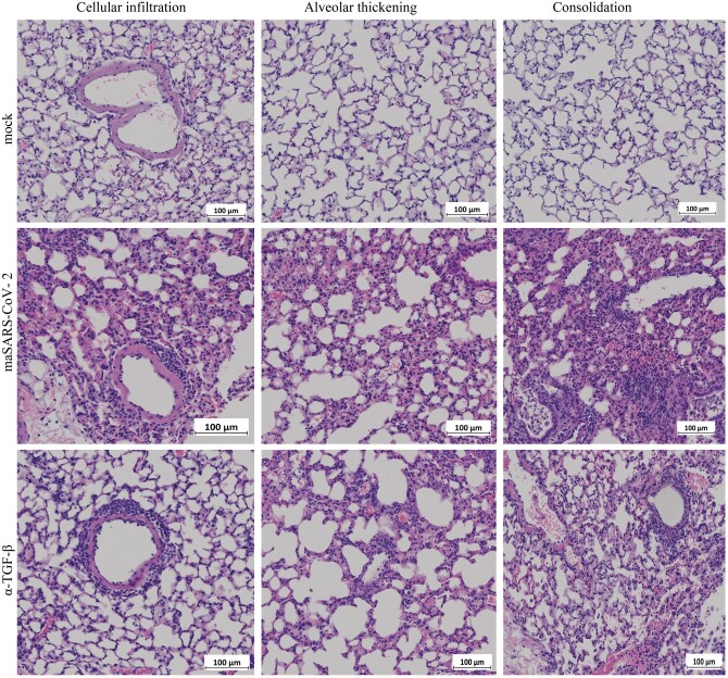 IL-4 and TGF-β regulate inflammatory cytokines and cellular infiltration in the lung and systemic IL-6 in mouse-adapted SARS-CoV-2 infection.