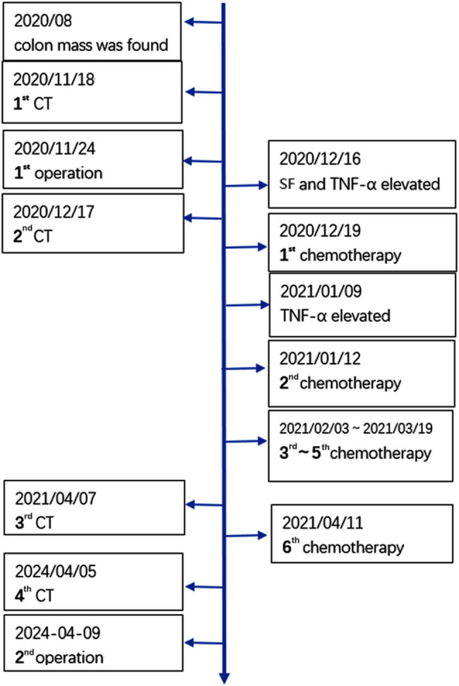 Solitary pulmonary metastasis with cystic airspaces in colon cancer: A rare case report.