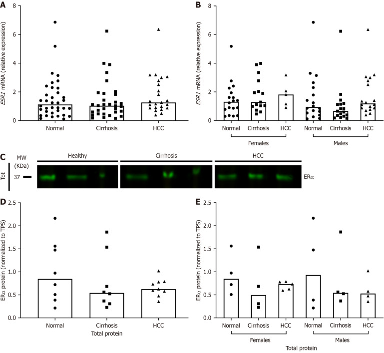 Sex based relative expression of estrogen receptors and tumor necrosis factor-alpha in liver affects hepatitis C virus viral pathogenesis.