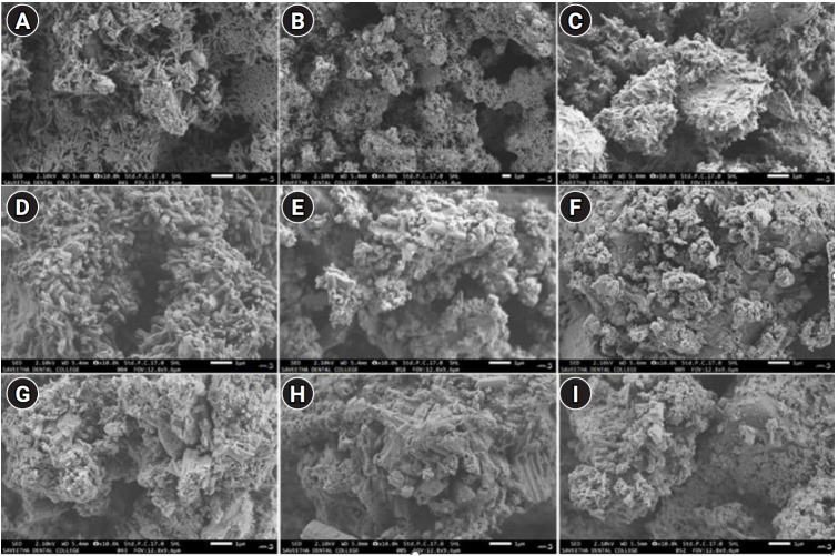 Structural and morphological characterization of silver nanoparticles intruded mineral trioxide aggregate admixture as a chair-side restorative medicament: an in vitro experimental study.
