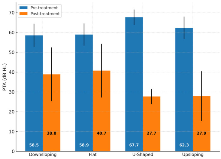 Audiogram Shape: Does It Have a Significant Prognostic Role in Idiopathic Sudden Sensorineural Hearing Loss Outcome?