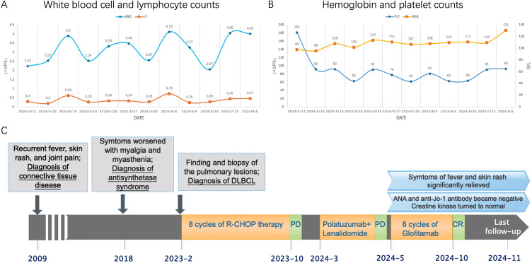 Successful Treatment of Diffuse Large B-Cell Lymphoma and Antisynthetase Syndrome with Bispecific Antibody Glofitamab.