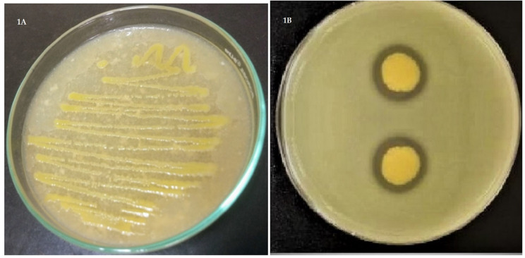 Novel thrombolytic protease from the rare halophile Brachybacterium paraconglomeratum: bioprocessing and in vitro application.