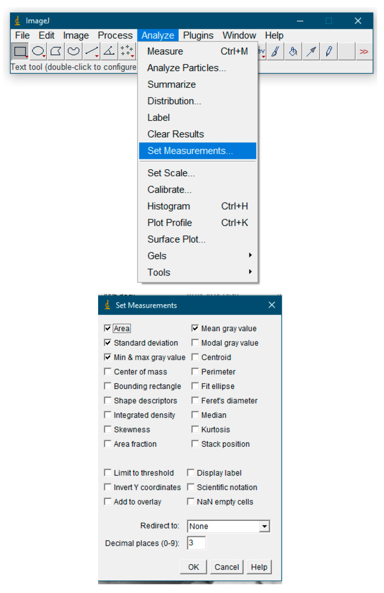 A New Method for the Digital Assessment of the Relative Density of Bone Tissue in Dentistry Using the ImageJ Software Package.