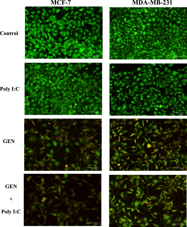 Genistein enhances TLR3-mediated apoptosis and immune signaling in breast cancer cells.