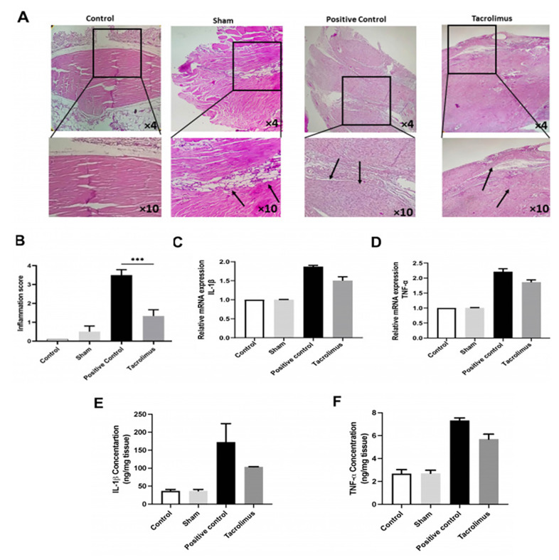 Anti-Fibrotic Effect of Tacrolimus on Preventing Adhesion after Achilles Tendon Surgery in a Murine Model.