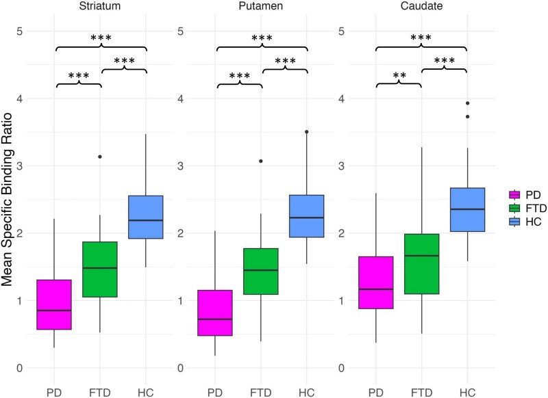 Striatal dopaminergic patterns and clinical features in frontotemporal dementia.