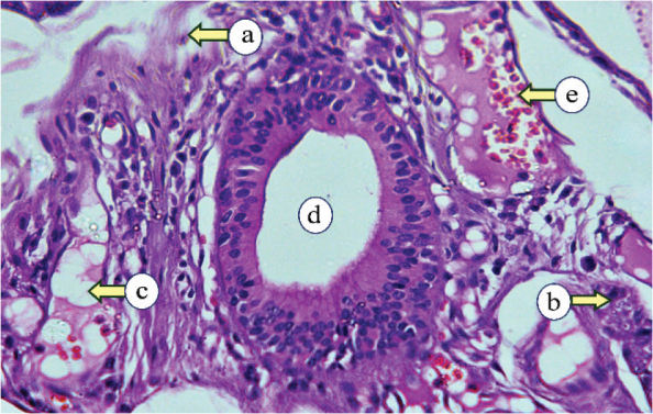Regenerative potential of the intermediate filaments of albino rat parotid glands subjected to fractionated radiotherapy: an immunohistochemical analysis.
