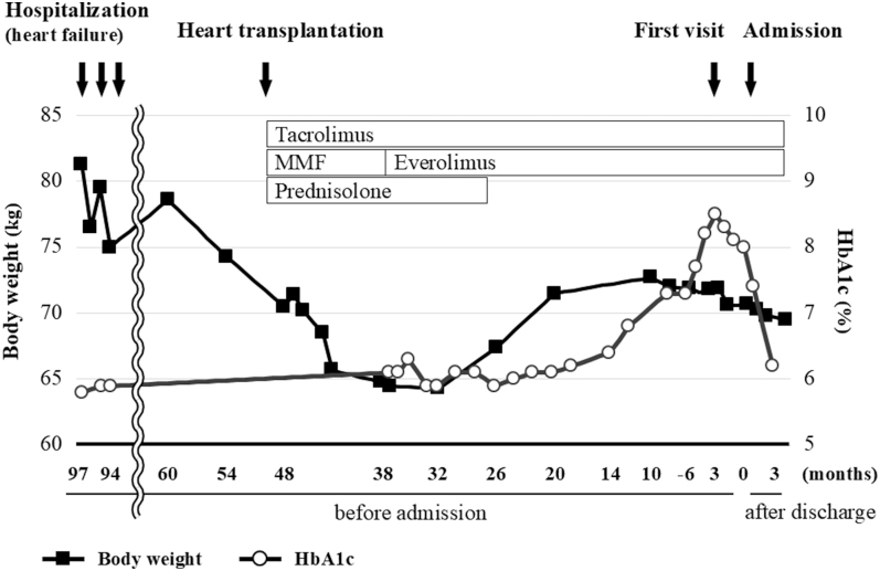 Decreased β-cell function in a case with Becker muscular dystrophy accompanied by post-transplant diabetes.