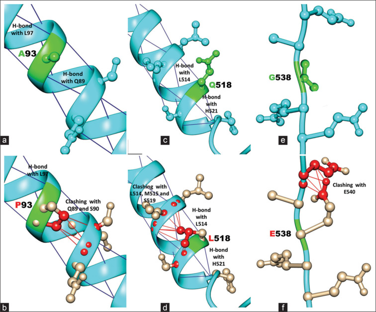 Paucity of optineurin gene variants in Indian juvenile open-angle glaucoma patients.