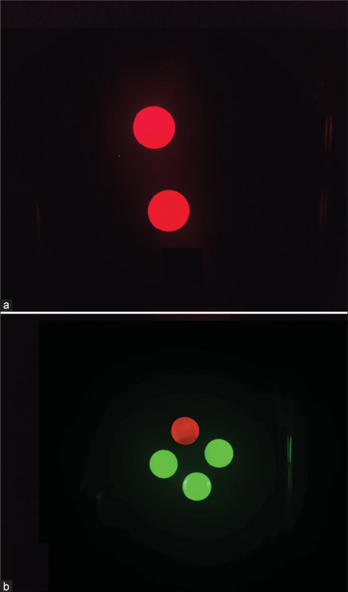 Evaluation of green filter leakage in the Worth 4 Dot test: Implications for clinical accuracy.